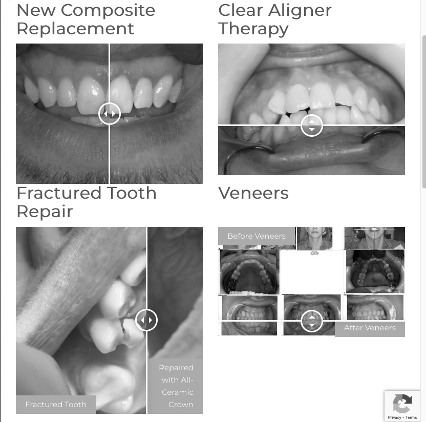 Before and After - sliders