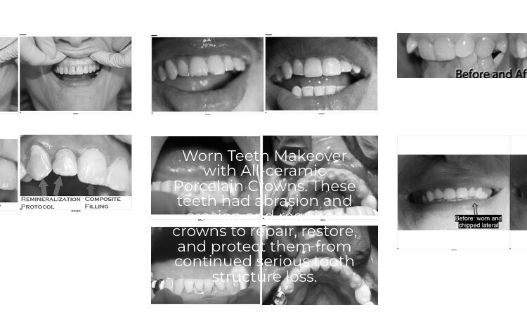 Before and After Photos